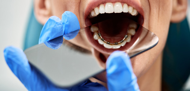 What Are The Different Types Of Braces?