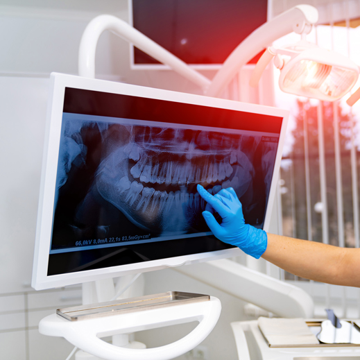 Orthopaedic treatment of the jaws